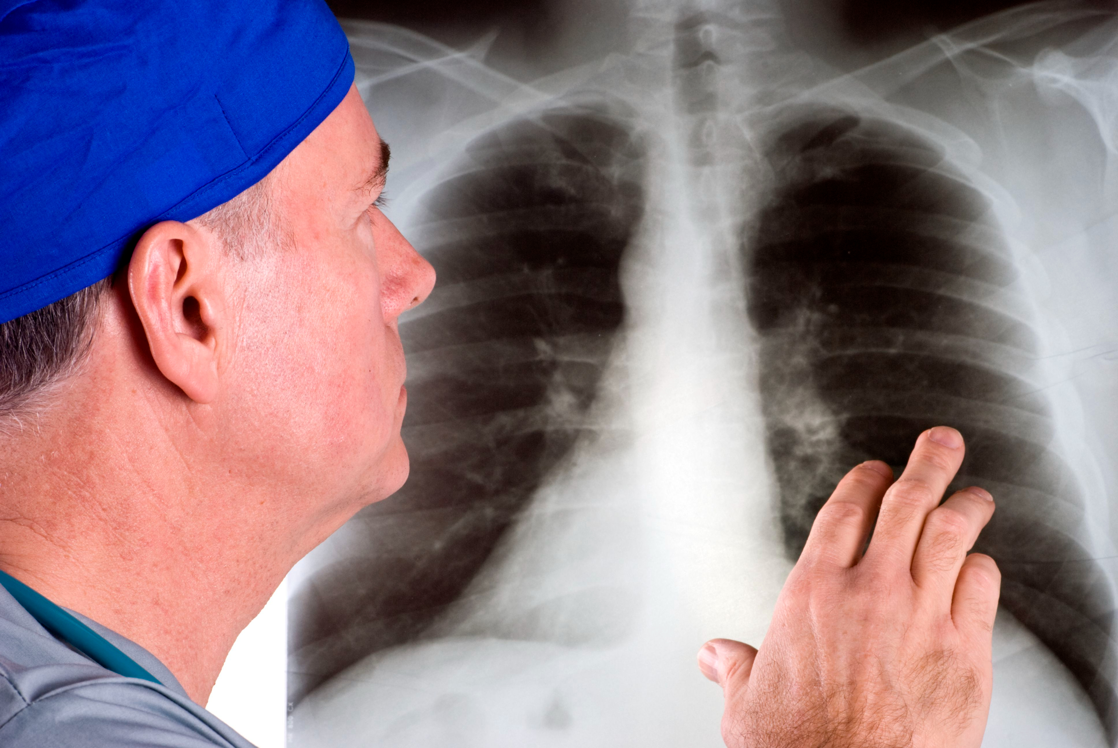 Рак легких отзывы пациентов. Повреждение органов дыхания. Опухоли органов дыхания. Онкологические заболевания легких. Патология органов дыхания.